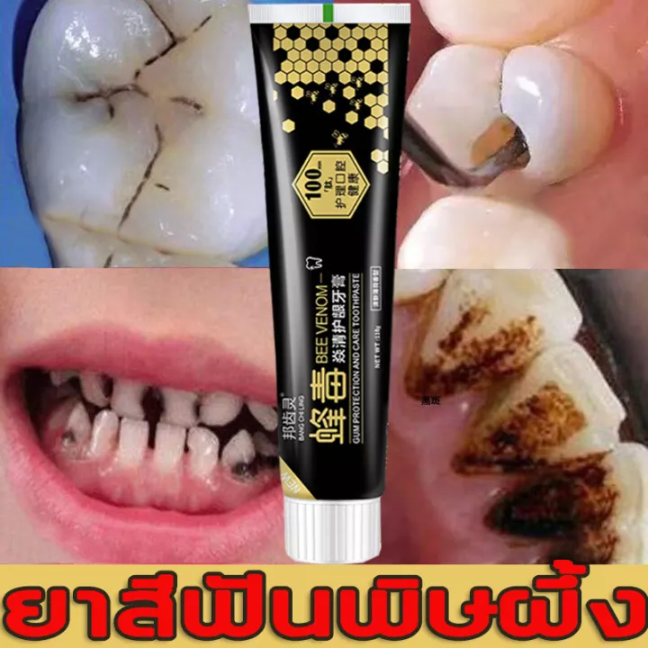 [สินค้าใหม่มาแรง ] CORANET ยาสีฟันพิษผึ้ง ยาสีฟันฟันขาว น้ำยาเคลือบฟัน ยาสีฟันชาโคล!!!