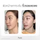 Parin Mini HIFU เครื่องยกกระชับใบหน้า ปรับหน้าเรียว ยกกระชับผิว. 