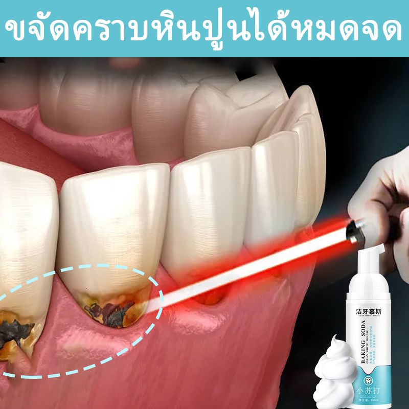 ราคา ยาสีฟัน ฟอกฟันขาว ยาสีฟันขจัดหิน ลบคราบบรี่กลิ่นปาก คืนฟันขาวๆให้คุณ น้ำยาขัดฟันขาวฟอกฟันขาวสวย ทำความสะอาดช่องปาก ลดหินปูน