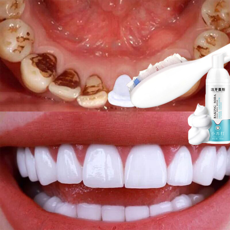 ราคา ยาสีฟัน ยาสีฟันฟันขาว มูสแปรงฟัน น้ำยาฟอกสีฟัน เซรั่มฟอกฟันขาว เจลฟอกฟันขาวเซรั่มไวท์เทนนิ่งสำหรับฟอกฟันขาว บำรุงฟัน แก้ฟันเหลือง ขัดคราบเหลืองคราบพฟัน ดับกลิ่นปาก สดชื่น