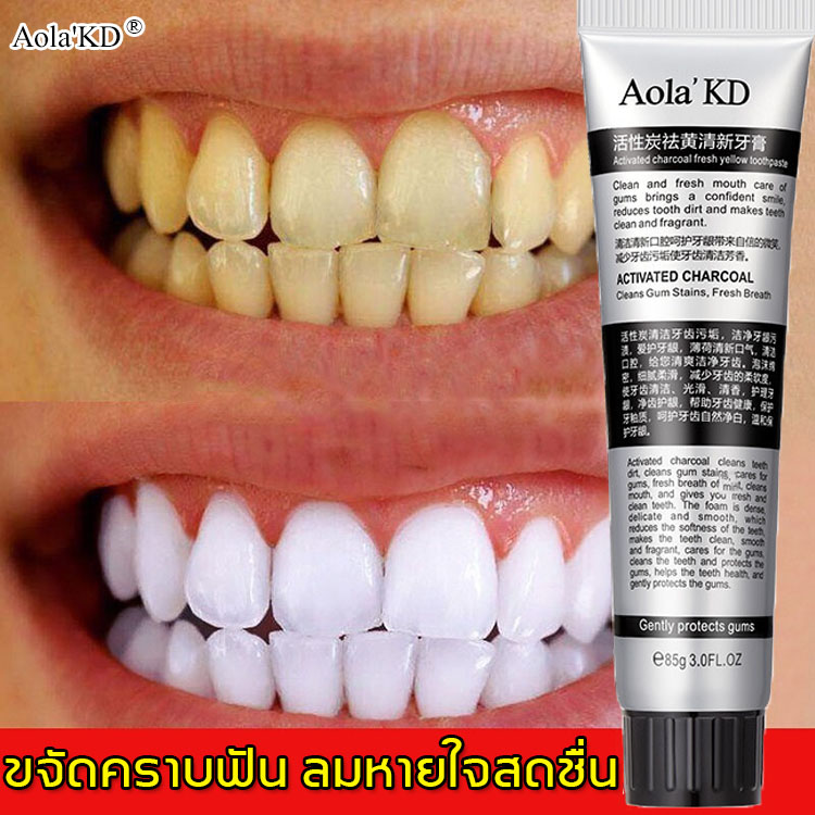 โปรโมชั่น Aola'KD ยาสีฟันฟันขาว ยาสีฟัน 85g ทำความสะอาดคราบฟันอย่างล้ำลึก ดูแลช่องปาก ลมหายใจสดชื่น(ขัดฟันขาว,ป้องกันกลิ่นปาก,ยาสีฟันฟอกขาว,ฟอกสีฟัน,ยาสีฟันไวท์เทนนิ่ง,ยาสีฟันฟอกฟันขาว,ฟันขาว,ยาสีฟันฟันขาว)